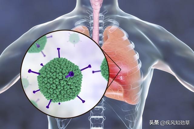 日本疯传的食人菌是什么？食人菌死亡率为什么那么高